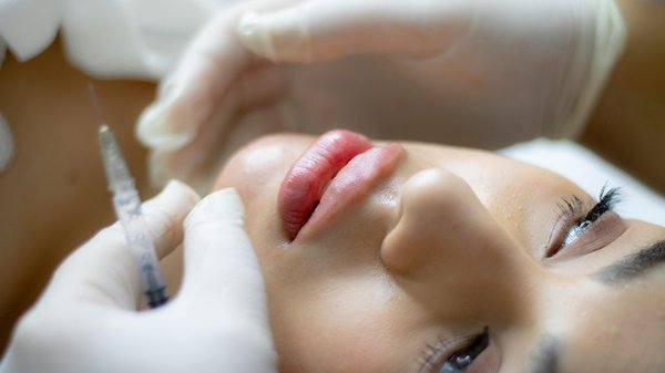 Achieve natural beauty with dermal fillers in london